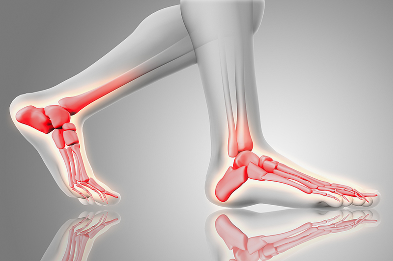 Vida Clinic Heel Pain