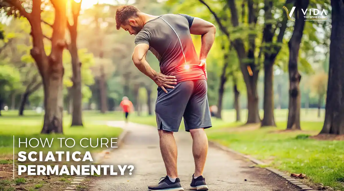 How to Cure Sciatica Permanently